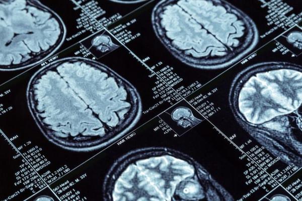 Image of a brain scan courtesy of the University's Medical Science Division 