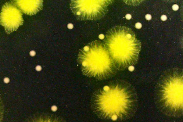 Photograph taken by Ross Gillespie (MPLS Division) of a Pseudomonas Bacteria.